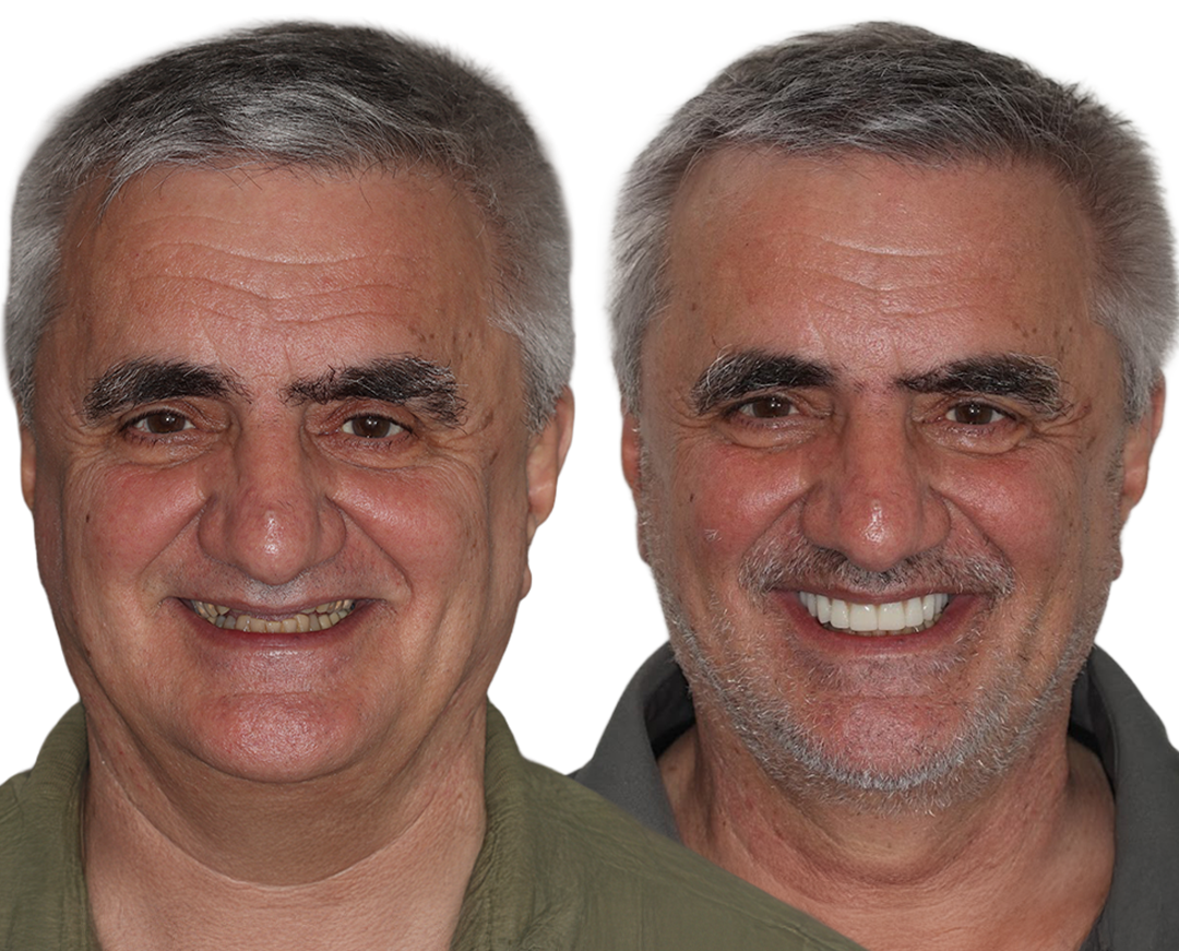 Dental-Care_Before-After
